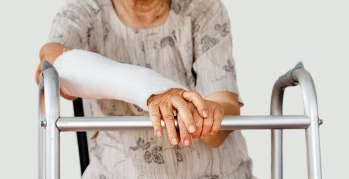 Seorang perempuan mengalami Gejala Awal Osteoporosis. Ia pun menjalani pengobatan Osteoporosis