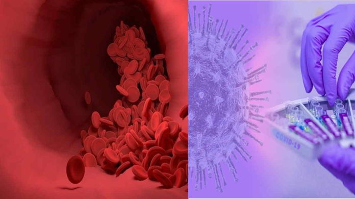 Komplikasi Virus Corona, Bisa Sebabkan Penggumpalan Darah