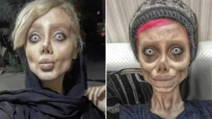 Sahar Tabar Resmi Dipenjara 10 Tahun Hasil Dari Wajah Mirip Zombie