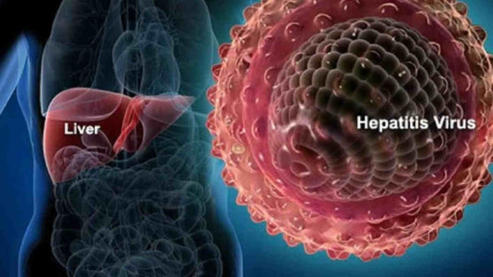 Pengobatan Penyakit Hepatitis A, Kenali Gejala dan Pencegahannya