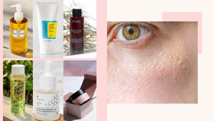 Skincare untuk mengatasi milia